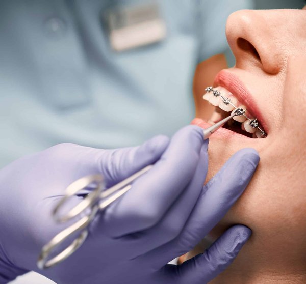 Tout savoir sur les services d'un orthodontiste à Mulhouse